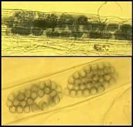 5 Figura 3. Morfologia de Polymyxa graminis.