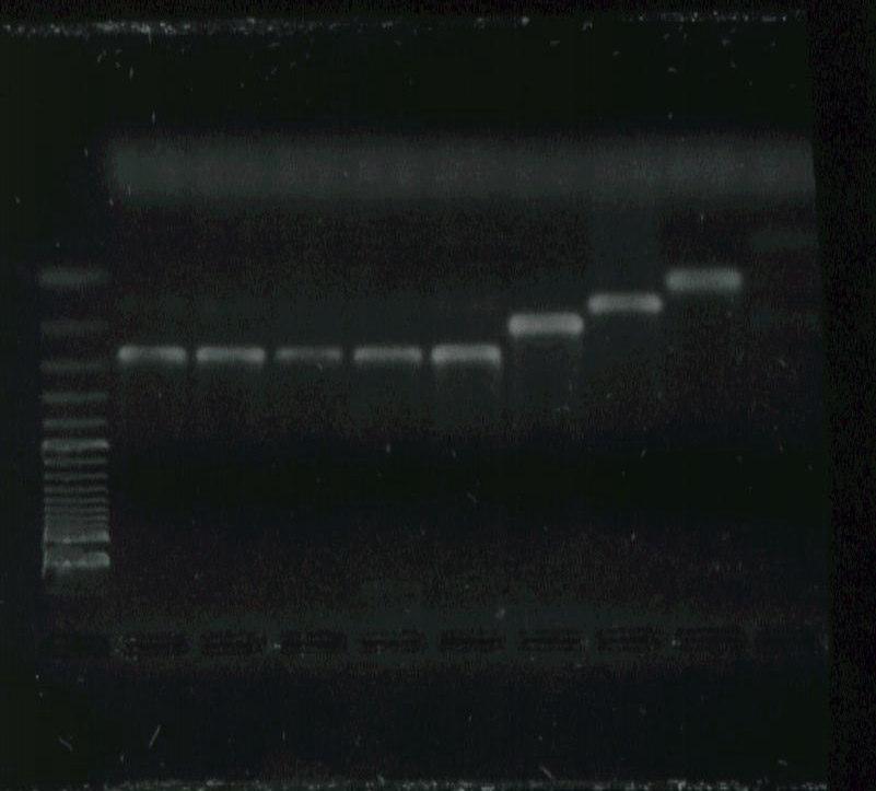 62 4.2- Caracterização Molecular: As quatro cepas foram caracterizadas por meio da amplificação, pela metodologia de PCR multiplex, de um segmento do espaçador não-transcrito do gene de mini-exon,