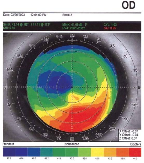 Figura 7 - Caso 2: Topografia pré-tosca