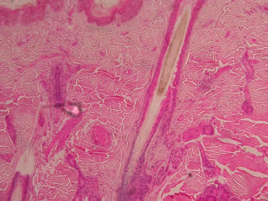 Observação com aumento total de 100x: Neste aumento, podemos observar a epiderme pouco espessa com queratina e o folículo piloso em corte longitudinal torna-se mais visível.