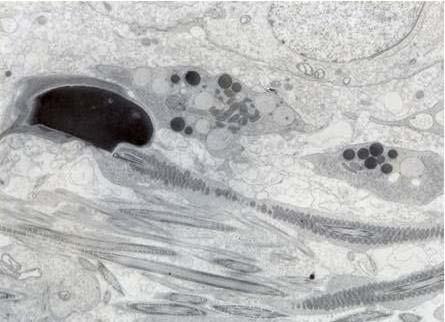 pela locomoção da célula. O acrossoma e o núcleo determinam a forma da cabeça do espermatozoide. Em roedores, ela tem a forma de foice, enquanto, em humanos, de raquete.