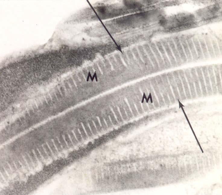 García-Fernández, University of Wisconsin-Milwaukee Eletromicrografia de corte transversal do espermatozoide de grilo (Acheta domesticus), onde é possível observar o axonema e os microtúbulos