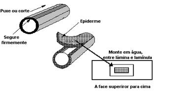 Ex: begonia Soros: estruturas reprodutoras encontradas nas pteridófitas.