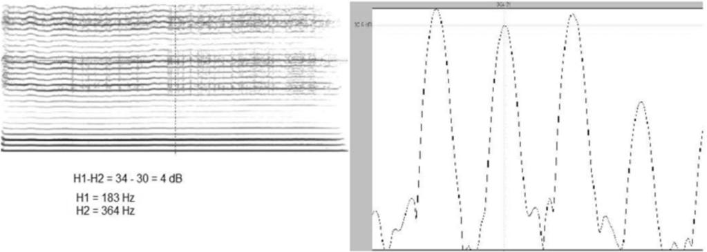 240 Cordeiro GF, Cunha MGB, Menezes MHM, Ubrig-Zancanella MT, Nemr K Figura 2. Espectrograma e espectro de vogal é sustentada com grau de soprosidade igual a 1.