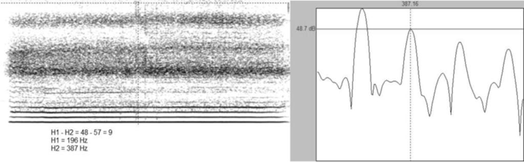 Espectrograma e espectro de vogal é sustentada com grau de soprosidade igual a 2. Diferença entre os harmônicos é igual a 9 db. O primeiro harmônico tem a frequência de 196 Hz e o segundo de 387 Hz.