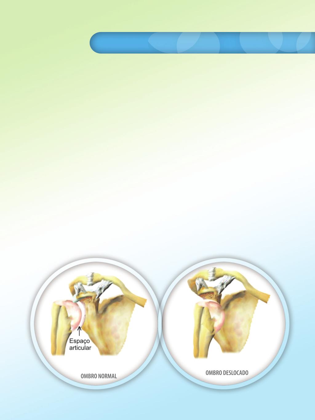 Conceitos Básicos INSTABILIDADE ARTICULAR: movimento articular anormal (excessivo), decorrente principalmente de lesões de ligamentos.