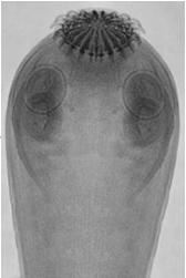 westermani - trematóides pulmonares Fasciolopsis buski - trematóide do intestino Austrobilharzia