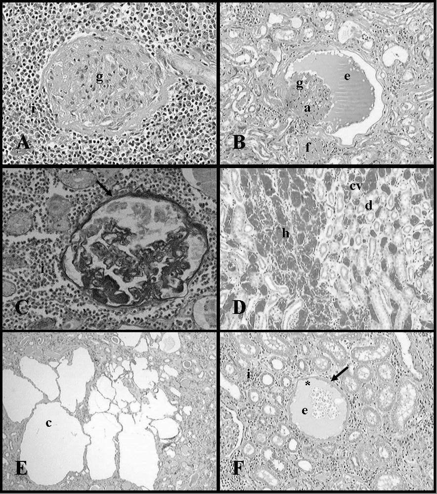 Bueno de Camargo et al. Figura 2. Fotomicrografias do tecido renal de cães portadores de insuficiência renal crônica.