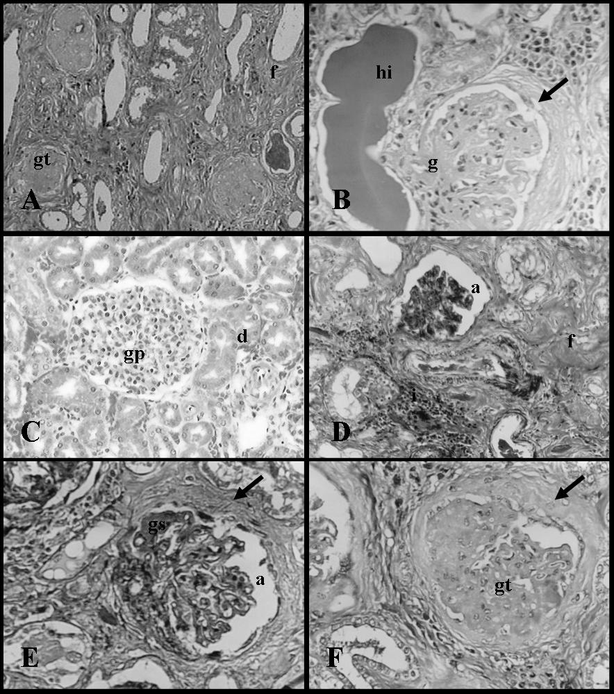 Bueno de Camargo et al. Figura 3. Fotomicrografias do tecido renal de cães portadores de insuficiência renal crônica.