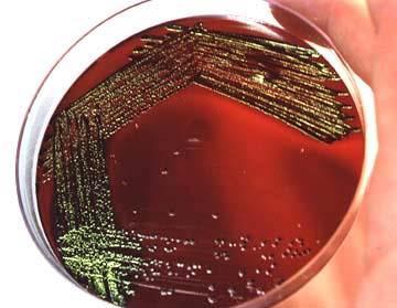 E.M.B. (Eosina Azul de metileno) Para isolamento de Enterobactérias (Gram negativo) Corantes inibem Gram-positivo Brilho verde metálico Escherichia coli?