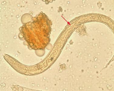 Larva rabditóide Primórdio genital desenvolvido