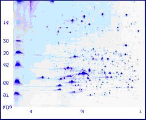 Cromatografia Géis bidimensionais: - Após