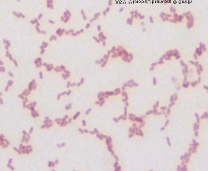 bactérias gram-negativas como Klebsiella pneumoniae (produtora da pululanase):