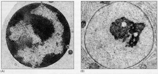 Eucromatinas: