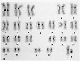 Regiões cromatínicas condensadas que podem reverter ao estado de eucromatina.