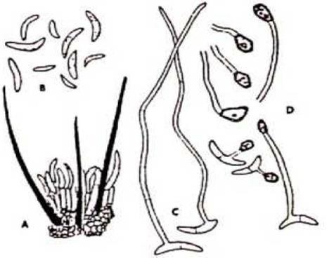 Colletotrichum truncatum Colletotrichum truncatum:.