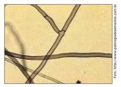 presença de micélio. Hifas jovens ramificadas em ângulos de 45º ou 90º.