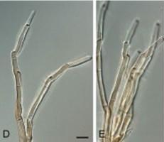 Cercospora sojina Com o tempo, a cor pardo-avermelhada enfraquece, formando um