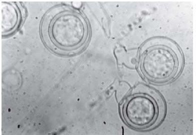 Phytophthora sojae P.