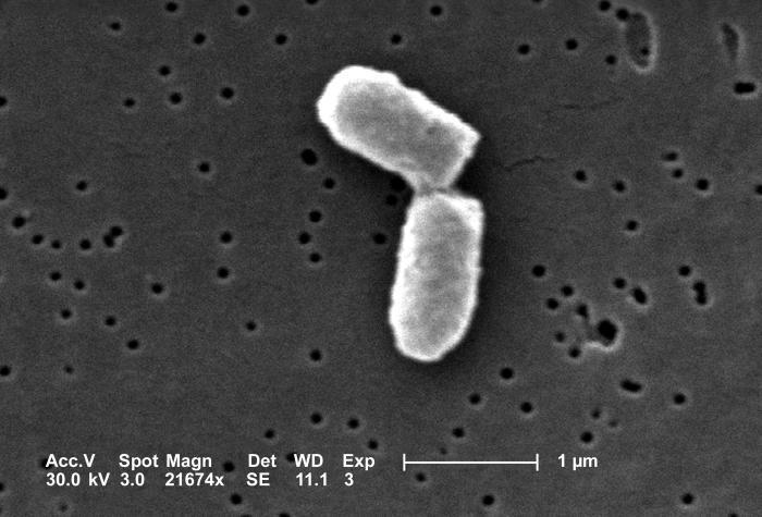 Micrografias seqüenciais das divisões iniciais de