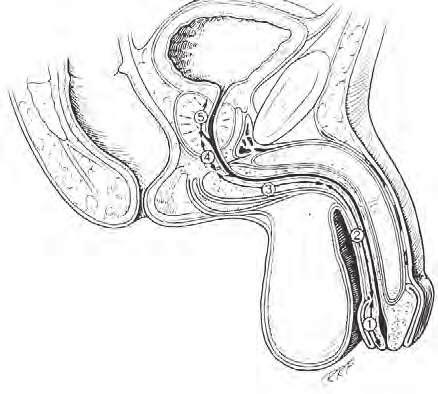 UROLOGIA FUNDAMENTAL INTRODUÇÃO Reconstrução urogenital tem como objetivo principal restabelecer o adequado esvaziamento do trato urinário inferior.