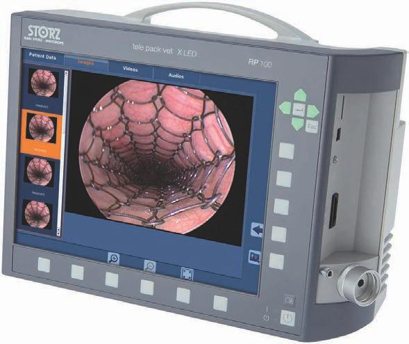 Unidade videoendoscópica móvel Cinco aparelhos em uma unidade compacta O potente aparelho all in one reúne tudo o que é necessário para a criação de imagens em Endoscopia: câmera, fonte de luz,