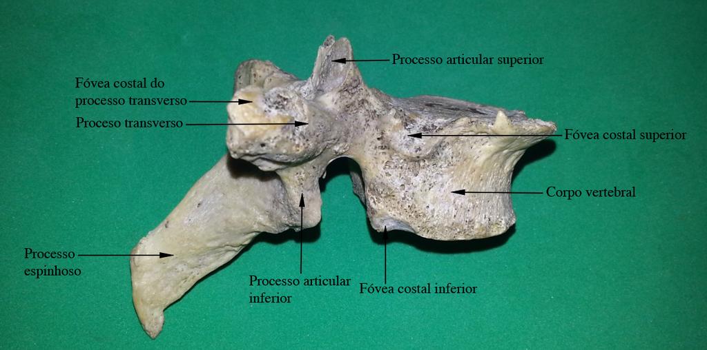 As vértebras torácicas são em número de doze (T1 a T12).