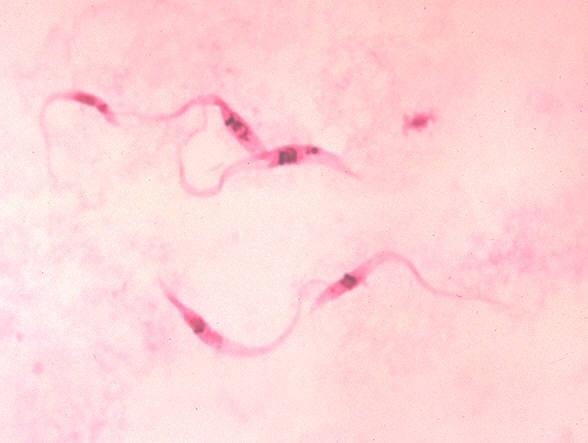 Doença de Chagas Agente etiológico: Trypanosoma cruzi