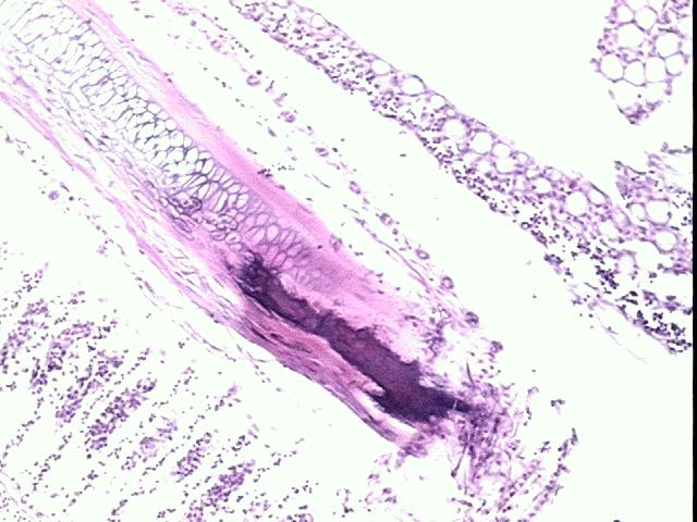 caraguatatubensis; b) parasita em vista lateral