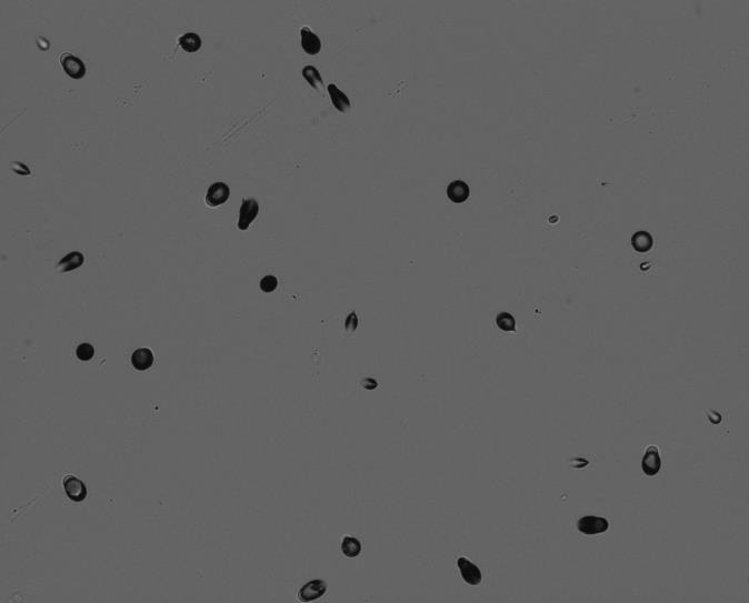 21 Figura 2 - Imagem de traços nucleares alfa capturada por microscopia óptica, com dimensões típicas nas condições de revelação desta pesquisa (10-50 µm).