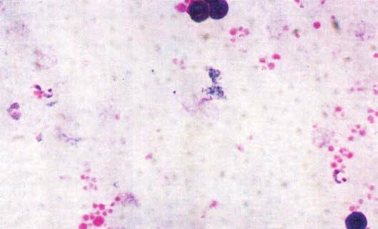 tripomastigota do Trypanosoma cruzi.