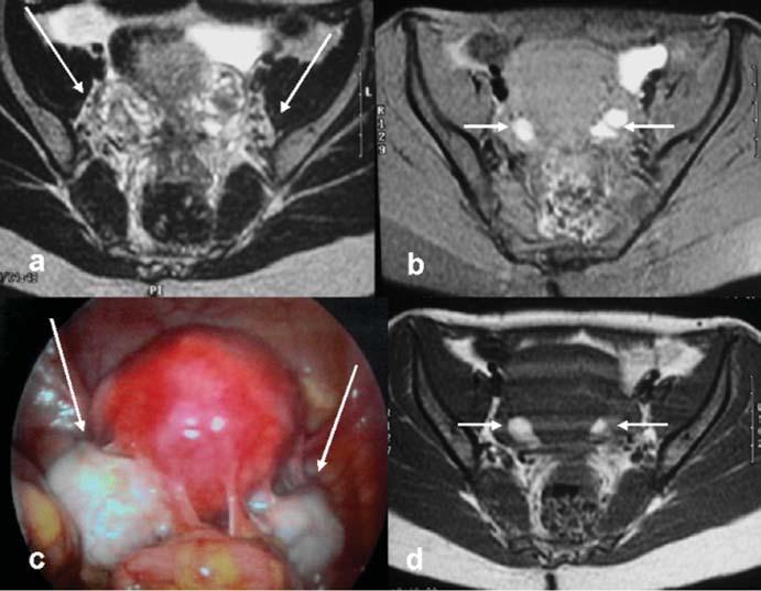 Coutinho Junior AC et al. vagina (4,7,8).