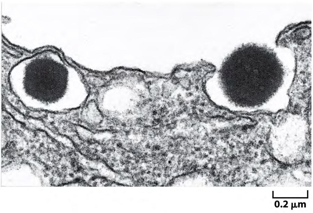 Exocitose de vesícula secretora Micrografia