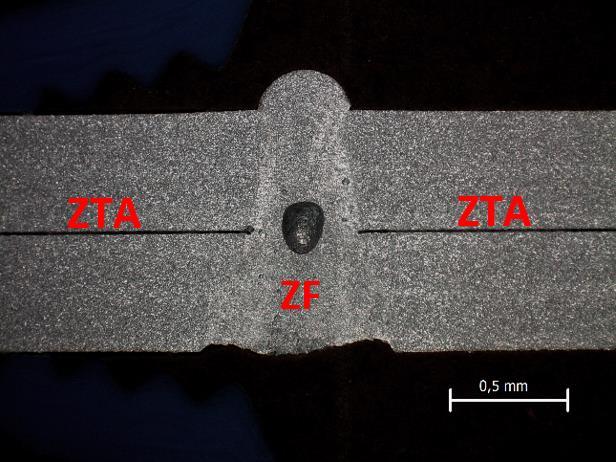 Figura 43- Macroestrutura da junta de LBW apresentando as diferentes zonas ZF e ZTA.