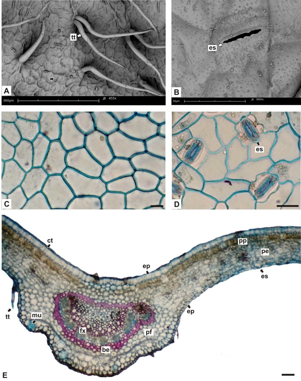 19 Figuras 7A E. Rollinia mucosa, FOLHA. A, B. VISTA FRONTAL DA EPIDERME, MOSTRANDO CUTÍCULA LISA, TRICOMAS TECTORES E ESTÔMATO (MEV); C, D. FACES ADAXIAL E ABAXIAL DA EPIDERME, RESPECTIVAMENTE; E.