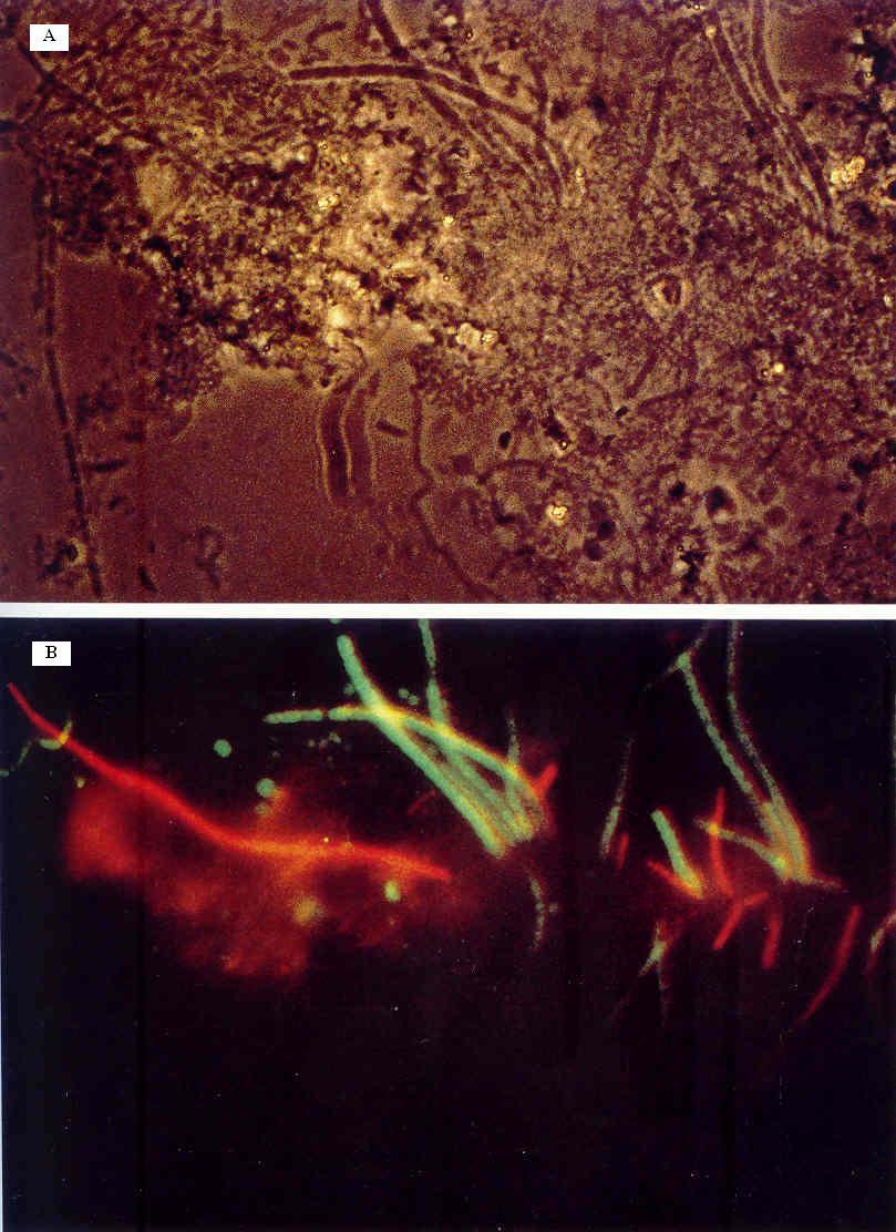 Figura 4.17. Thiothrix sp. e tipo 021N em lamas activadas são notórias com a introdução de determinados oligonucleotidos.