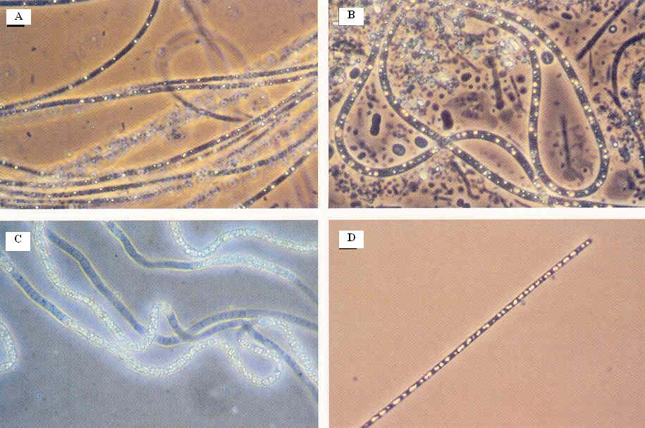 Figura 4.20. Micrografia de fase de contraste destaca grânulos de enxofre em: A) Thiothrix sp., B) Beggiatoa sp., C) tipo 021N e D) tipo 0914 (JENKINS et al., 2004).