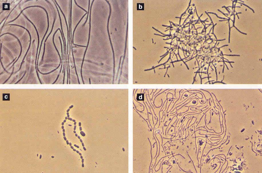 Figura 4.21. Micrografia de fase de contraste de: A) M. parvicella, B) Nocardio C) tipo 1863 e D) tipo 0211 (JENKINS et al., 2004). Foi executado um estudo por D.