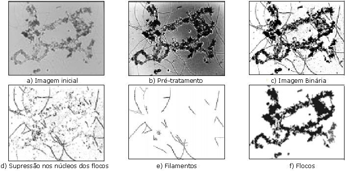 as espumas e outras substâncias que funcionam como substrato para as Nocardia (Faria et al., 2002). Pelo programa de Da Motta et al.