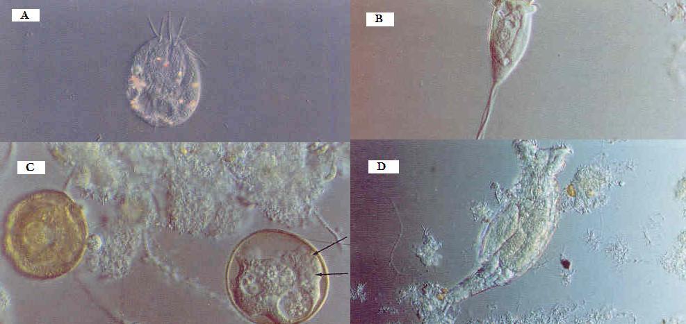 a 37,5ºC. Na preparação de amostra fresca foi possível observar uma diversidade de microrganismos (Figura 6.12).