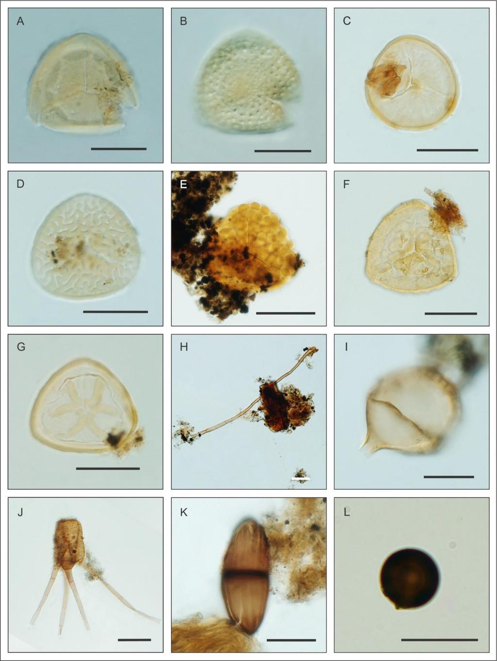 Figura 12. Fotomicrografias dos palinomorfos recuperados no poço PCSC-3. Esporos determinado: (A-B) Huperzia.