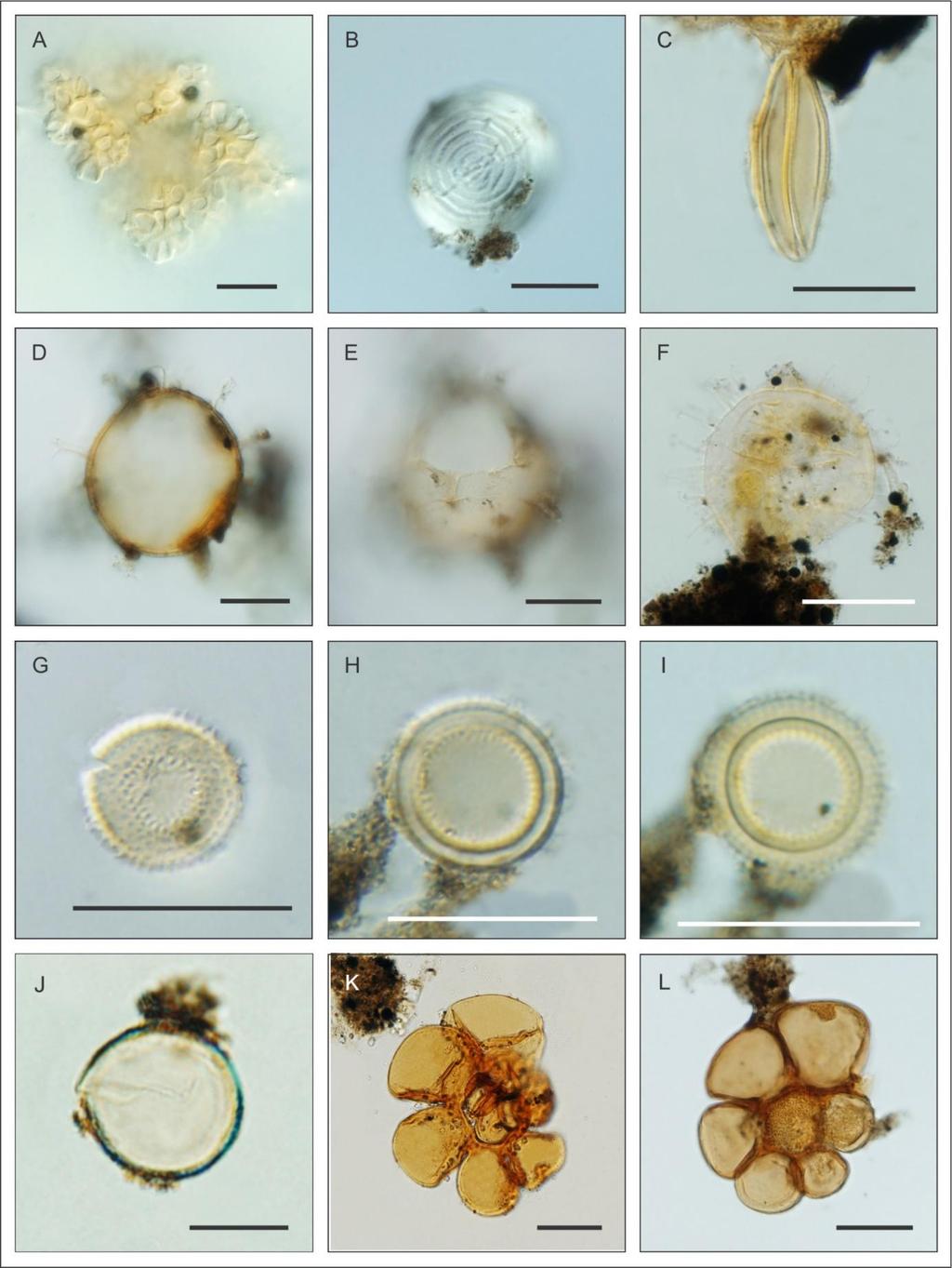 Figura 13. Fotomicrografias dos palinomorfos recuperados no poço PCSC-3. Algas determinadas: (A) Botryococcus, (B) Pseudoschizaea rubina, (C) Spirogyra.
