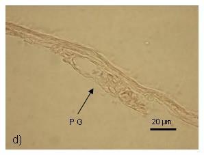 espermatogônias (esp) na região mais periférica d) Detalhe de gônada primordial (PG) indeterminada Analisando a Figura 3 constata-se que em todos os tratamentos, a partir da