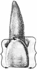 3 Coroa Clínica 3) Eixo Vestibular da Coroa Clínica (EVCC): porção mais proeminente do lóbulo