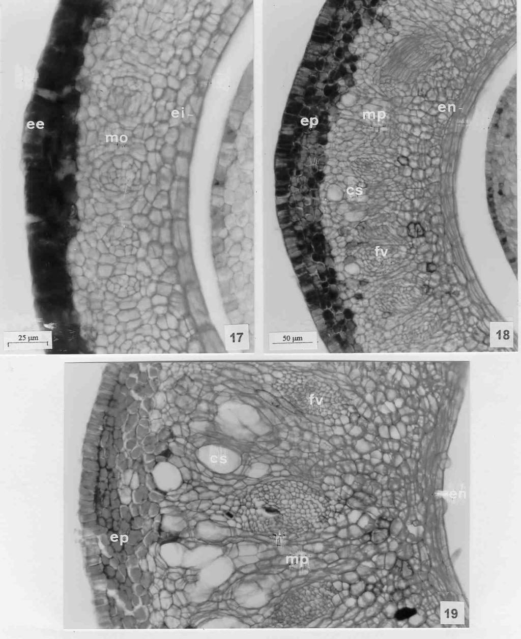 556 Albiero et al. Figuras 17-19. Sapindus saponaria - Seção transversal da parede ovariana, do pericarpo em um fruto muito jovem (mericarpo = 4.0 x 2.0 mm) e em um mais desenvolvido (mericarpo = 5.