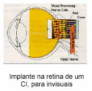 implantados no