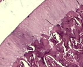 Figura 1 - Fotomicrografia de uma secção tíbia do rato 1 submetido à