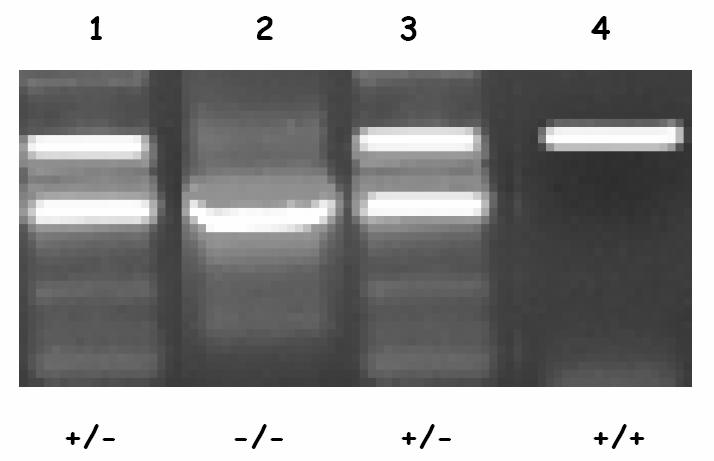 Marcadores Moleculares Pontos de referência no genoma variações comuns/raras na seuência de DNA entre indivíduos Posição conhecida Passíveis de Genotipagem Alu repeat no Chr 8