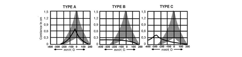 A timpanometria e a impedanciometria são realizadas com a introdução de uma sonda de vedação no conduto auditivo externo, capaz de emitir um tom puro de 220 Hz.