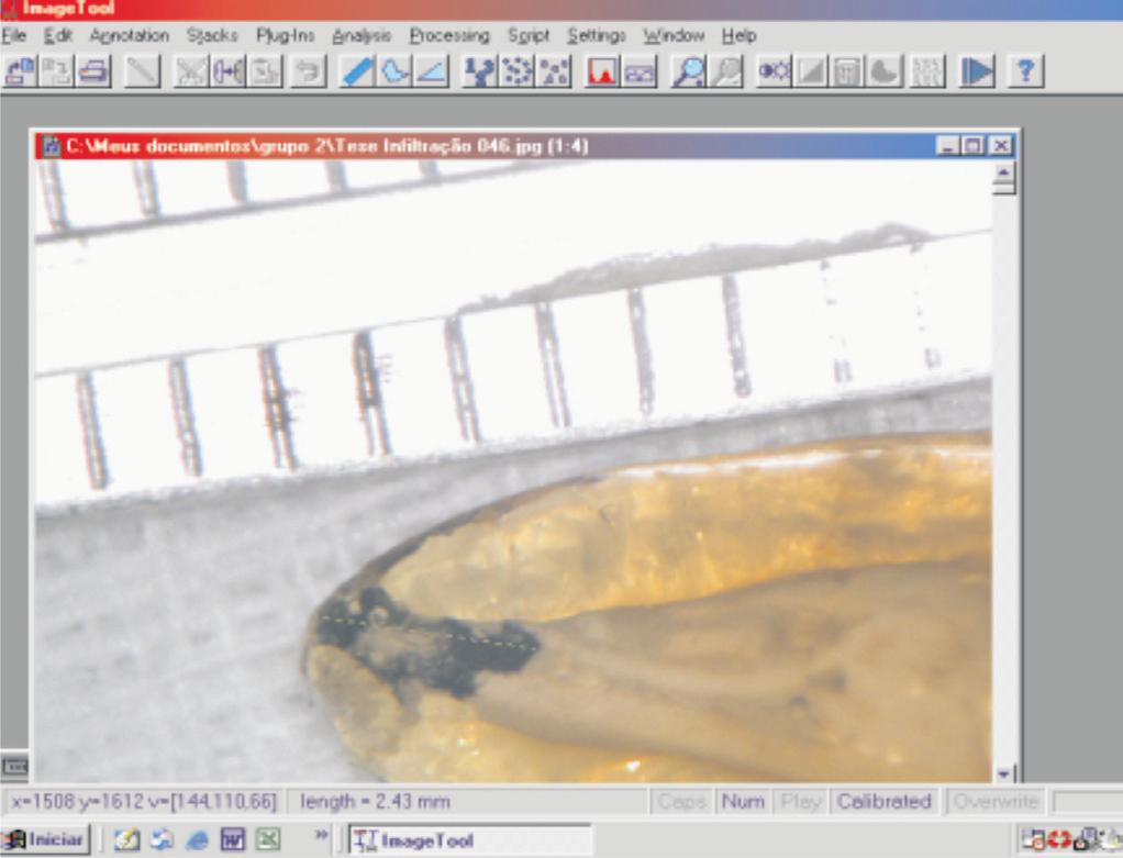 Tabela 1 - Médias de Infiltração Figura 2- Avaliação da apical pelo Programa ImageTool RESULTADOS As médias de, expressas em milímetros, estão apresentadas na Tabela 1.